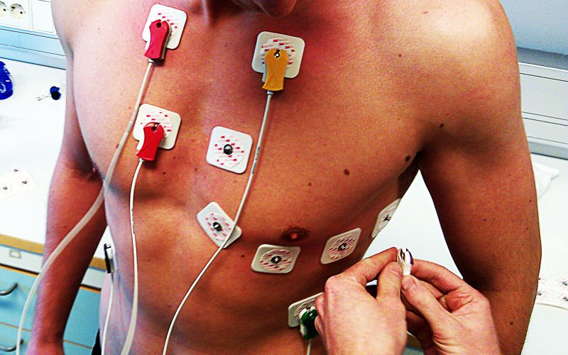 Hva er et EKG, og hvordan fungerer det?